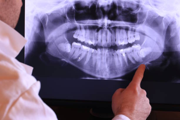 Best Tooth Pain Emergency Relief  in Harrisonburg, VA