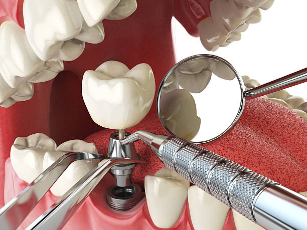 Best Broken Tooth Emergency  in Harrisonburg, VA